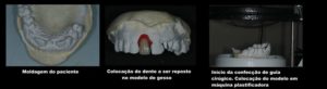 12514078 1158202927532696 2129576976506962594 o 300x82 - Implantes Dentários