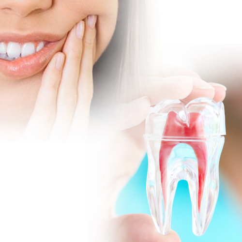 Root canal treatment 500х500 - Tratamento de canal