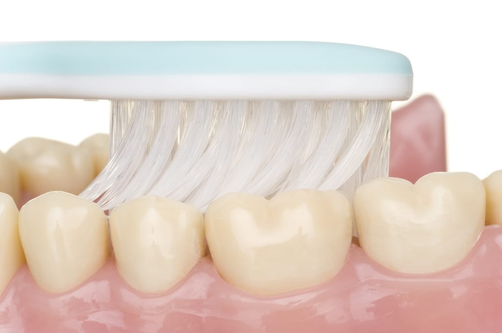 Escovação de dentes sobre implante — cuidado diário para manutenção