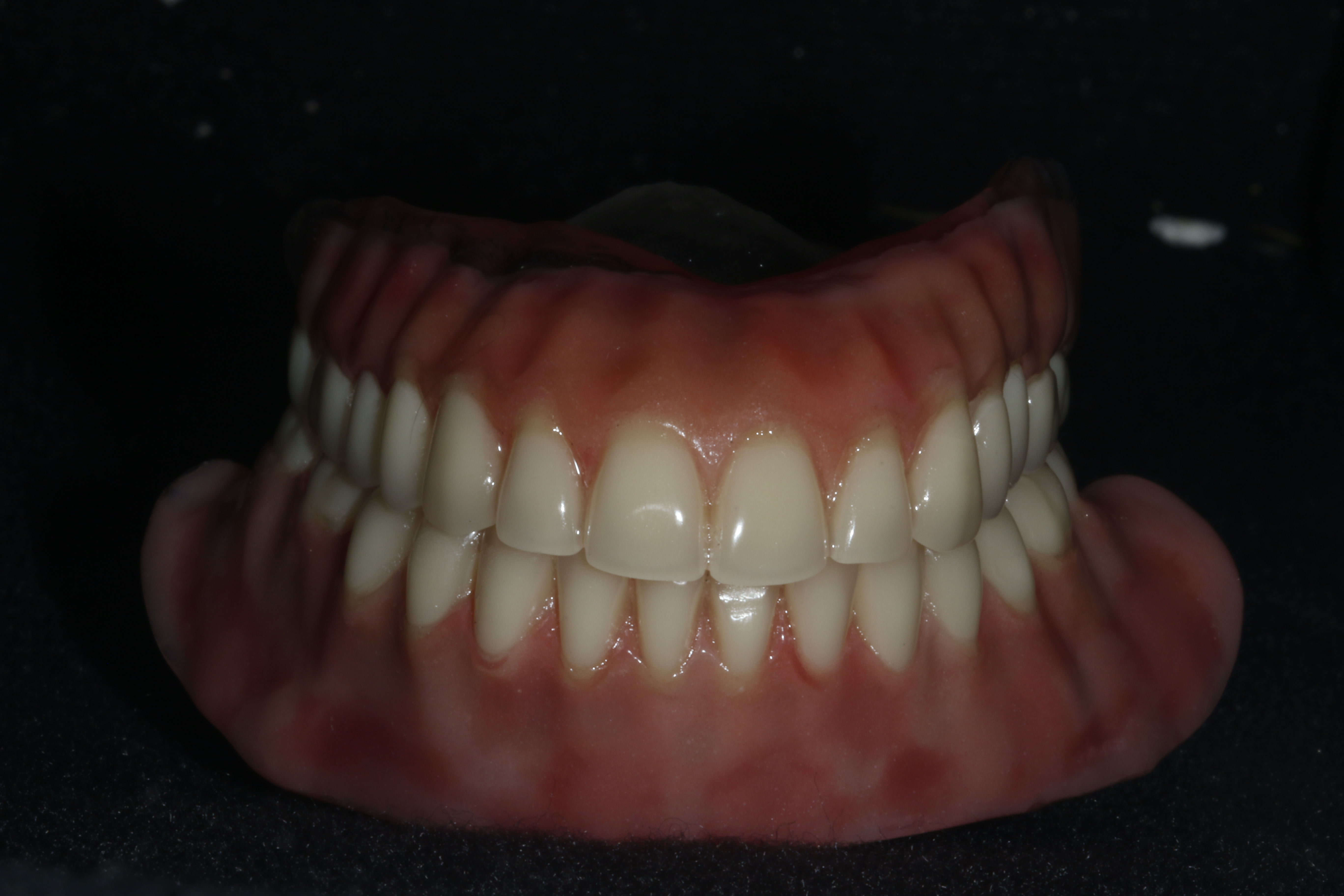 MG 8031 - Dentadura Fixa