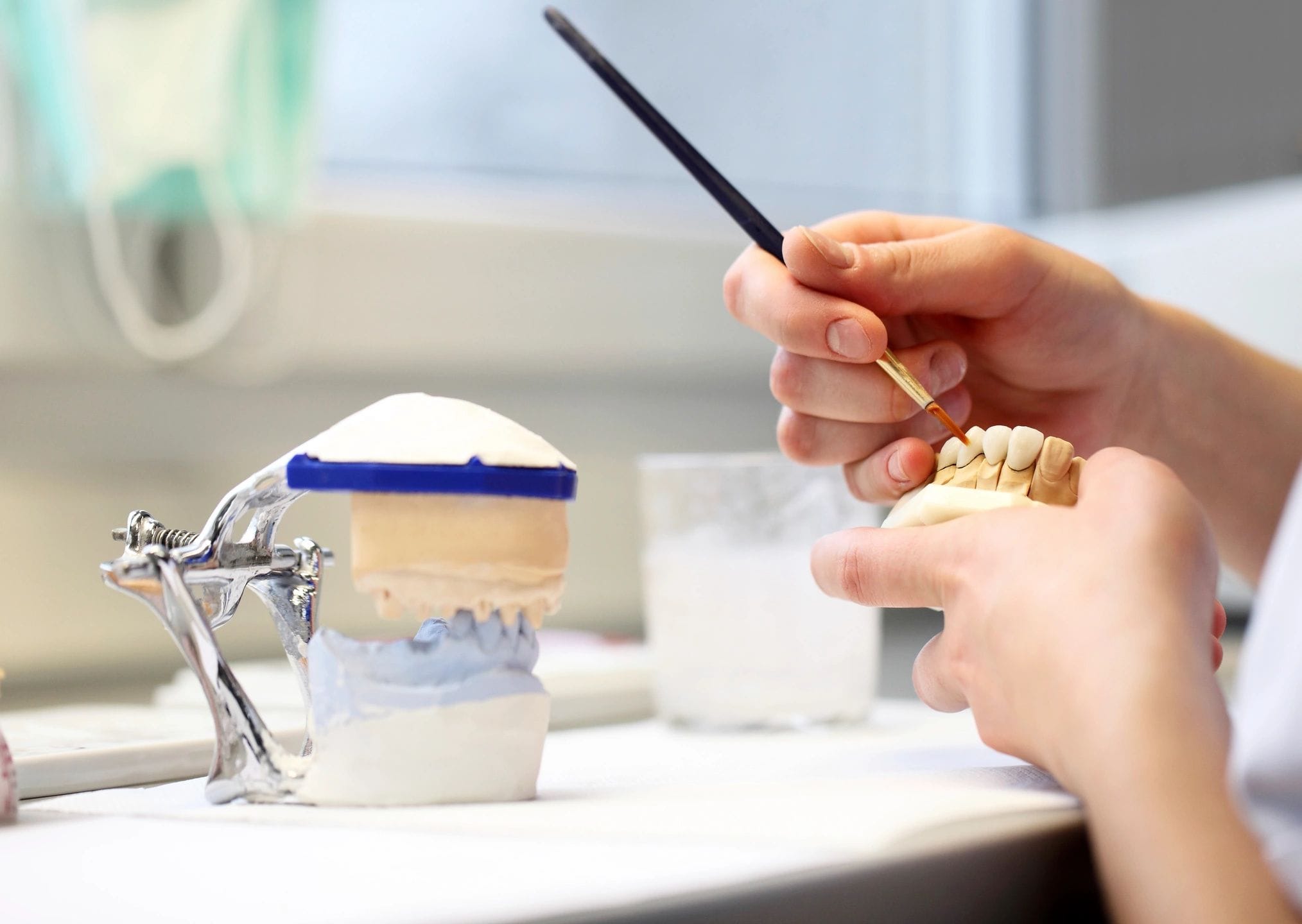 Trabalho de laboratório — confecção de coroa e restauração de porcelana