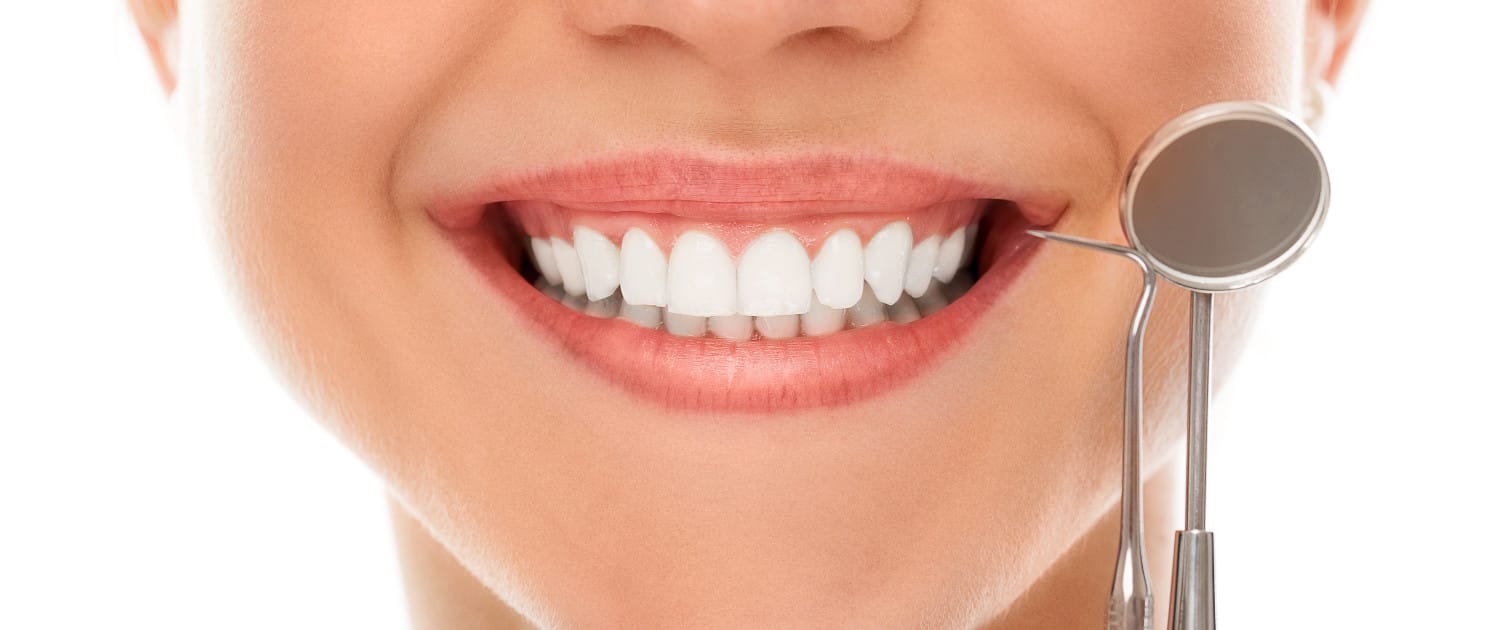Resultado de estética dental — sorriso harmonioso