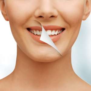 clareamento dental 300x297 - Estética
