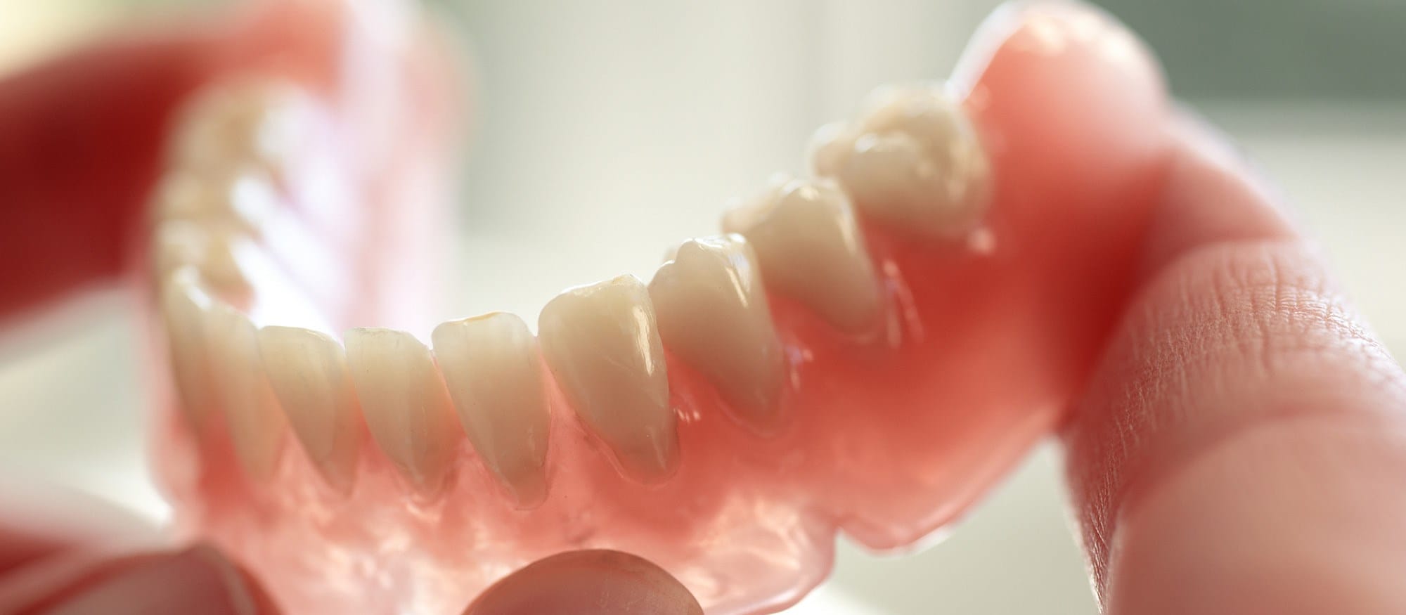 Dentadura convencional — prótese total removível
