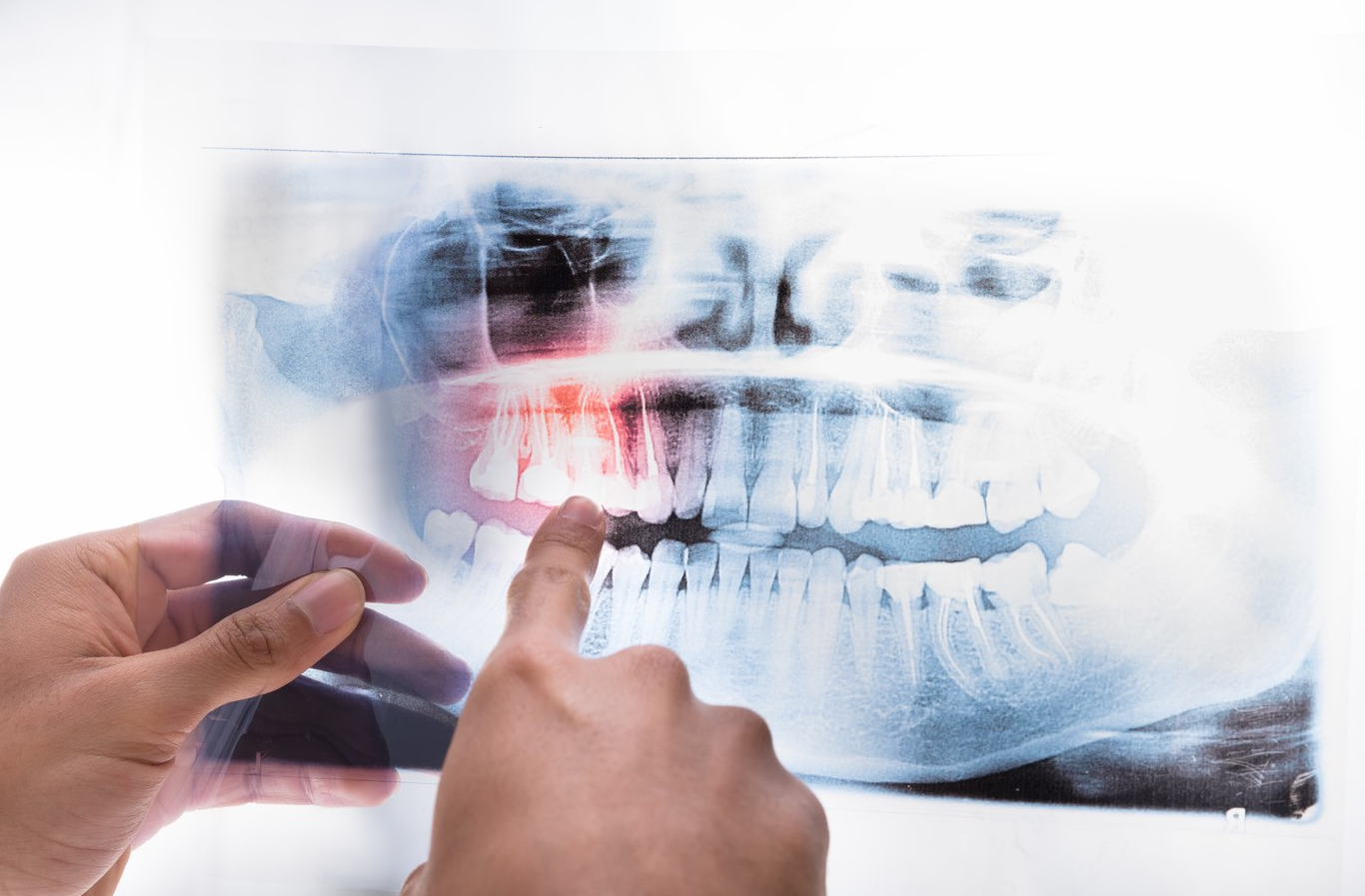 Dentista analisando radiografia panorâmica — diagnóstico preciso em Divinópolis com raio-X digital