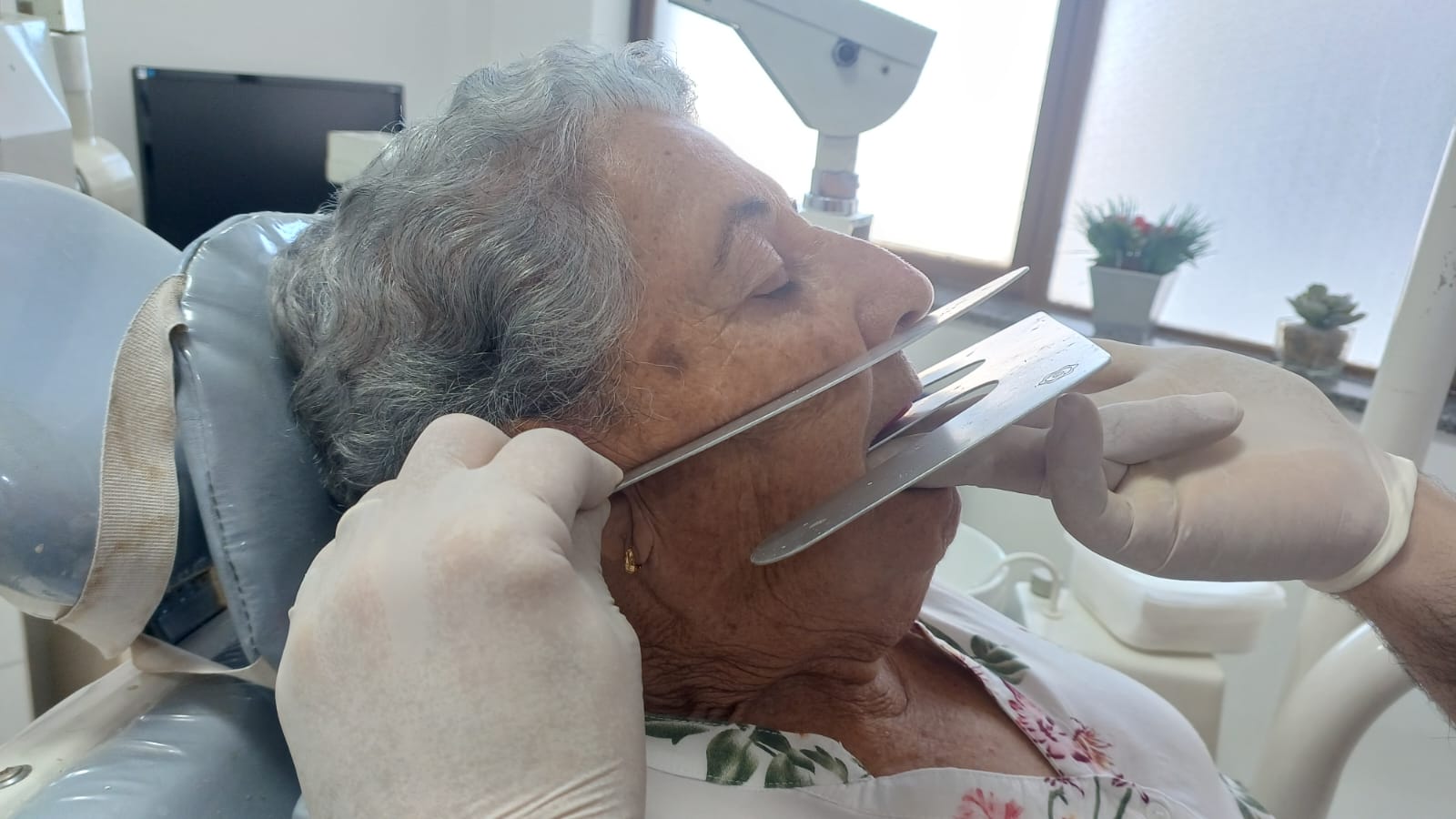 Régua de Fox lateral — verificação do plano oclusal