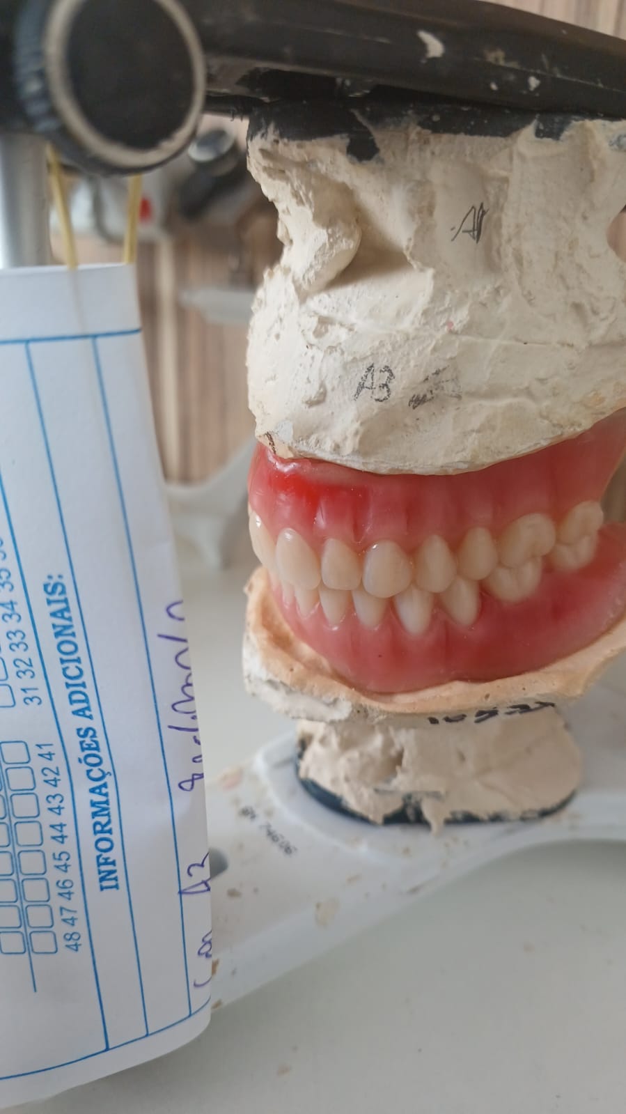Prova em cera — dentes montados no articulador para aprovação do paciente