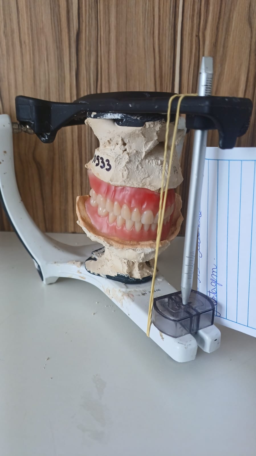 Prova em cera — vista frontal no articulador