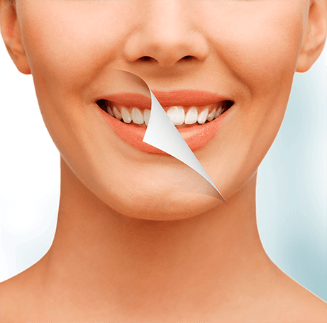 Clareamento dental — antes e depois — dentes mais brancos