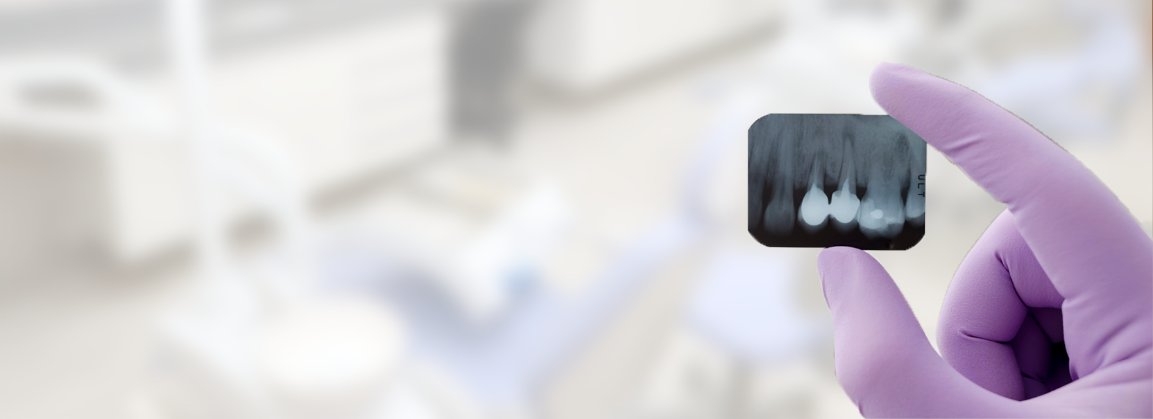 Endodontista segurando radiografia de canal dentário