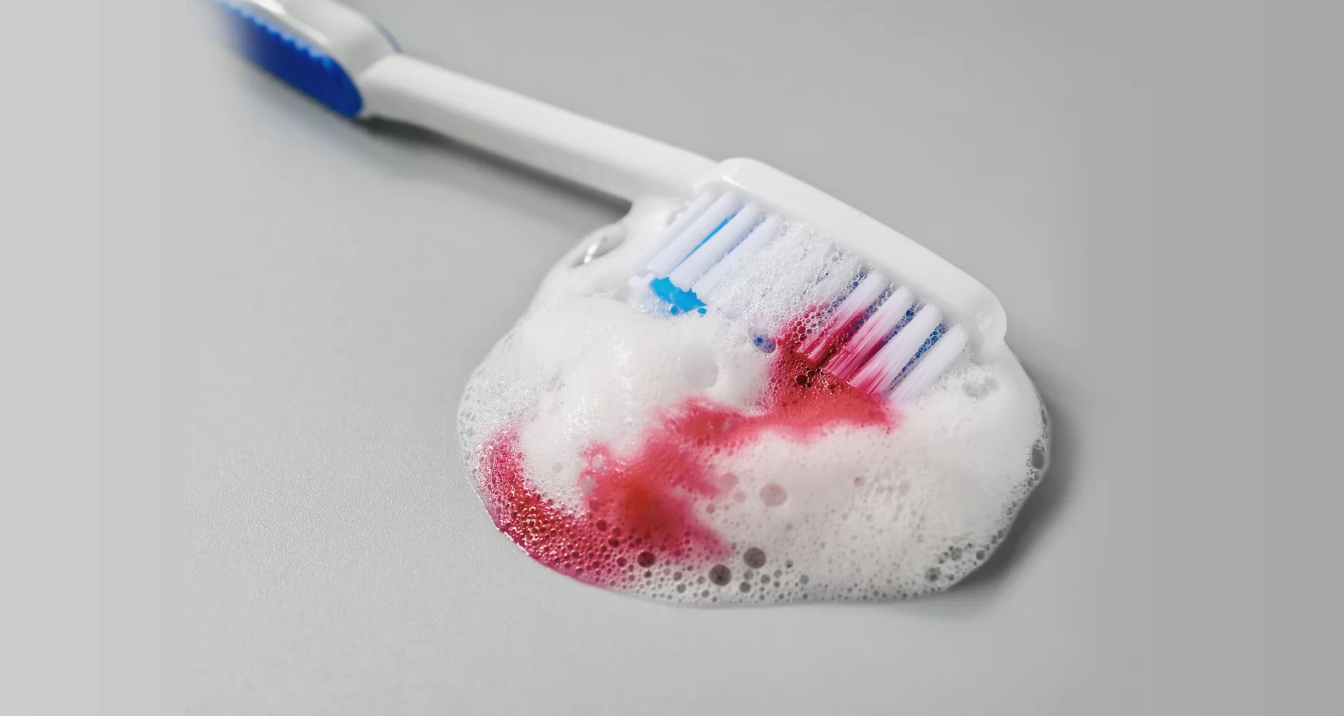 Escova de dente com sangue — gengiva sangrando ao escovar — sinal de gengivite