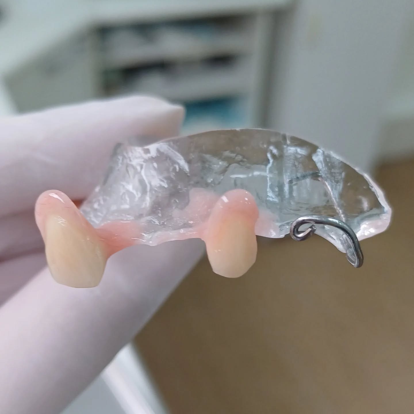 PPR provisória com 2 dentes repostos