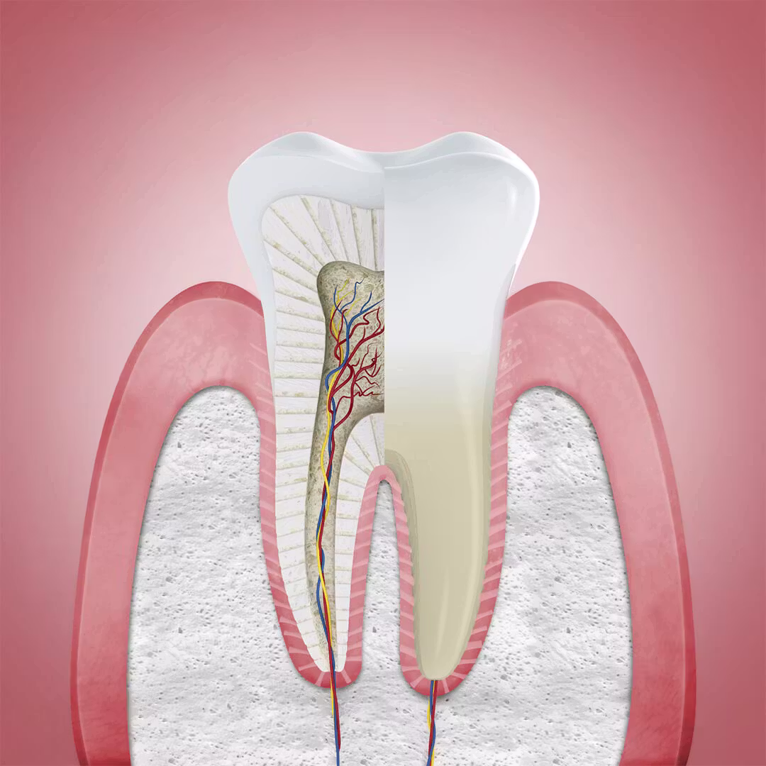 Gengiva saudável — corte transversal do dente e osso