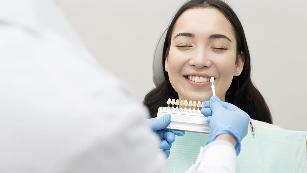 Escolha da cor do dente com escala de cores para clareamento e facetas