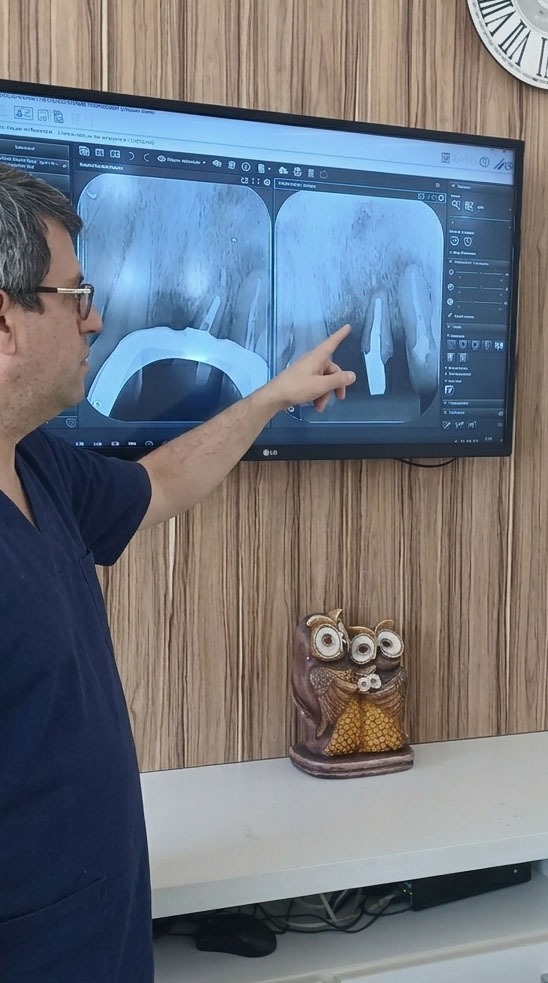 Dr. Luís Morato apontando a radiografia digital na tela do consultório em Divinópolis